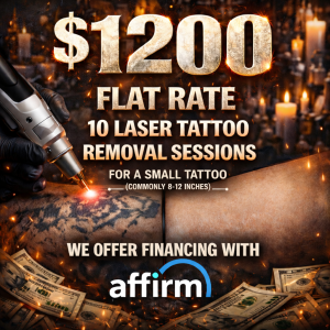 $1,200 Laser Tattoo Removal Package – 10 Sessions (Small Tattoo)