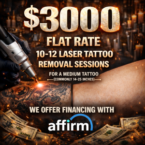 $3,000 Laser Tattoo Removal Package – 10–12 Sessions (Medium Tattoo)