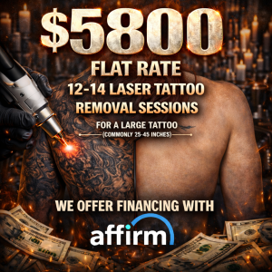 $5,800 Laser Tattoo Removal Package – 12–14 Sessions (Large Tattoo)